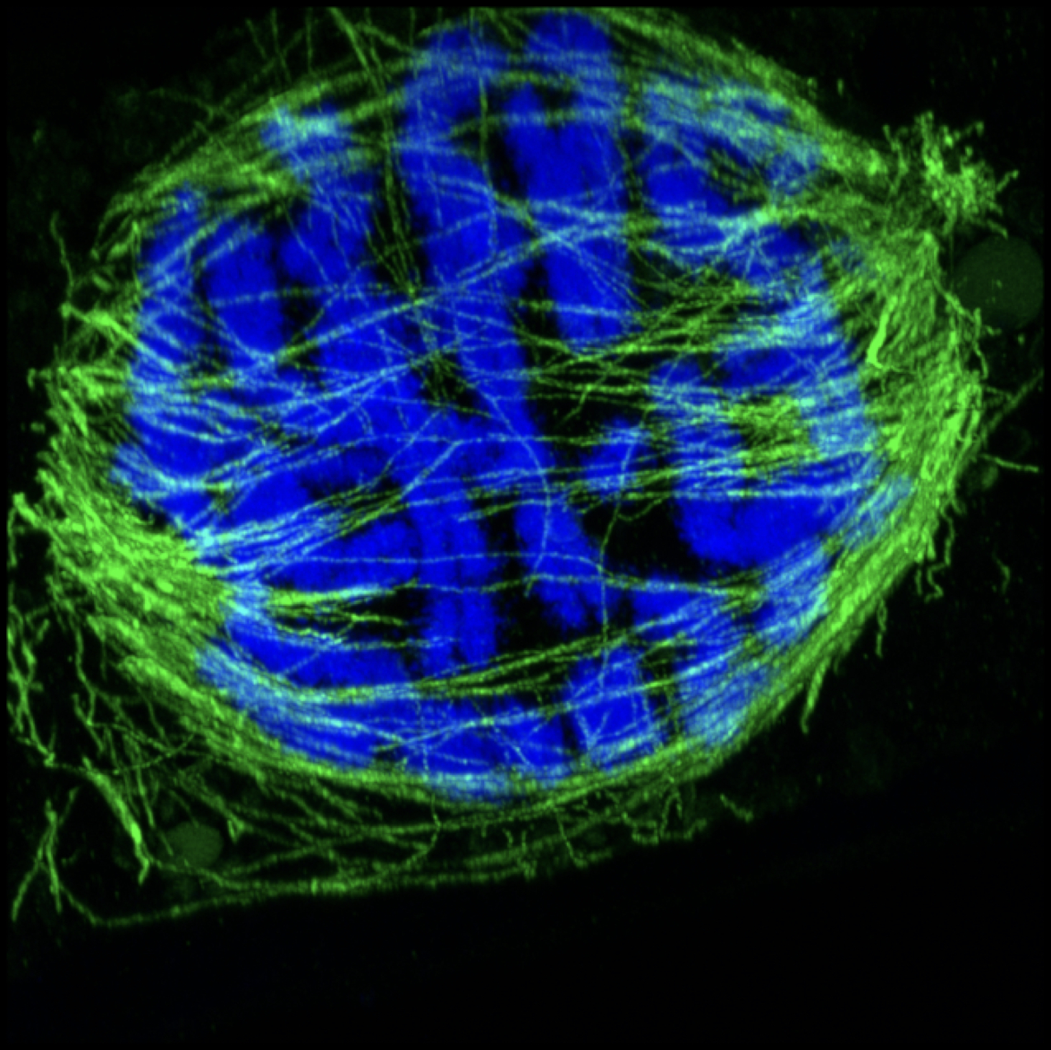 Plant superresolution technique - Metaphase Spindle